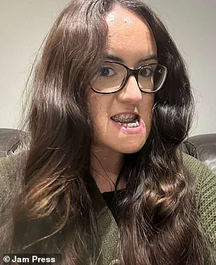 Luisa McDermott's Transformative Journey: Overcoming a Severe Underbite with Double Jaw Surgery