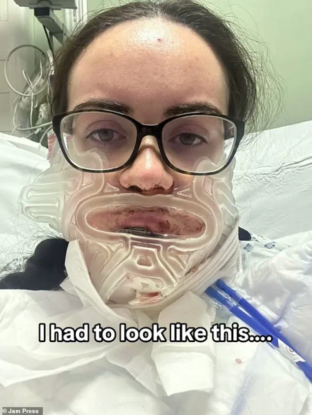 Luisa McDermott's Transformative Journey: Overcoming a Severe Underbite with Double Jaw Surgery