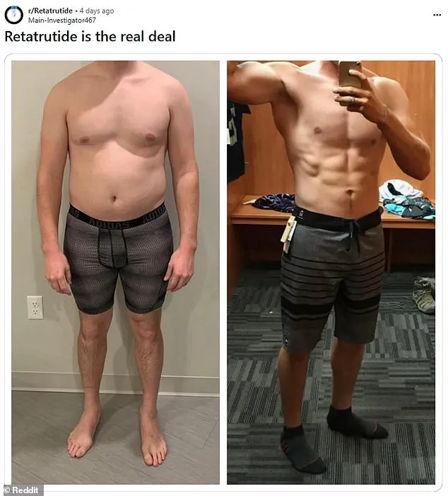 Black Market Demand Surges for 'Godzilla' Weight Loss Drug Retatrutide, Developed by Eli Lilly