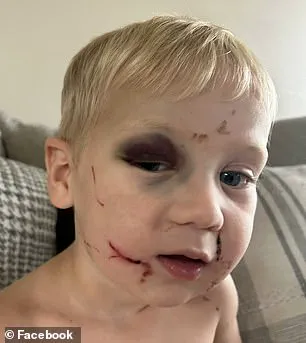 Daycare Worker Arrested in Georgia Over Alleged Child Abuse Incident Sparks Debate on Regulatory Oversight in Childcare Facilities