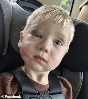 Daycare Worker Arrested in Georgia Over Alleged Child Abuse Incident Sparks Debate on Regulatory Oversight in Childcare Facilities