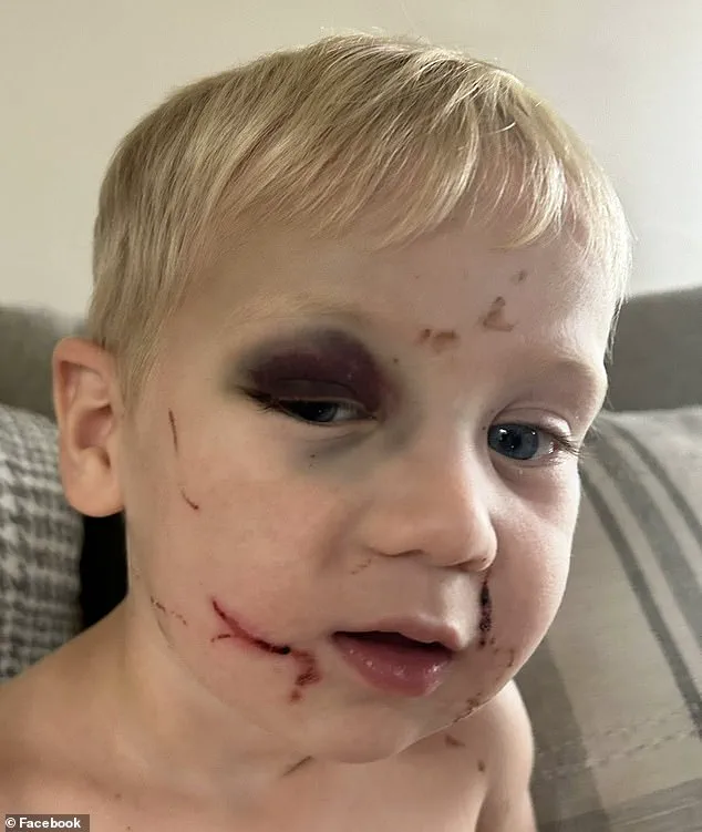 Judge Under Threat After Granting Bail to Daycare Worker Accused of Injuring Toddler