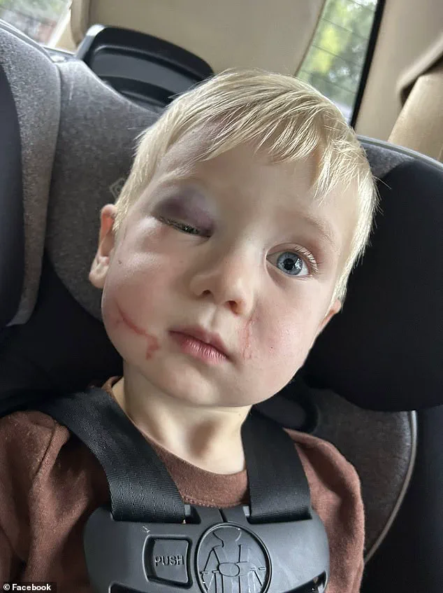 Judge Under Threat After Granting Bail to Daycare Worker Accused of Injuring Toddler