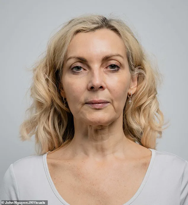 The Silent Collapse: A Journey Through Aging and the Transformation of the Neck