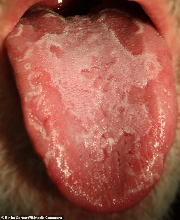 Exclusive: Kate McKinnon Reveals Her Privileged Access to a Rare Tongue Condition