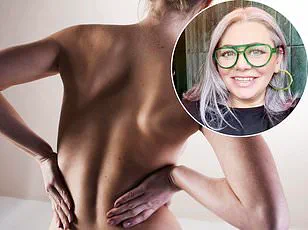 Revolutionary Gel Could Transform Arthritis Treatment, Offering Hope to Millions