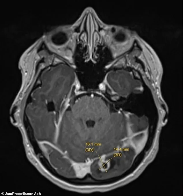 New Mother's Seizure Reveals Life-Threatening Brain Tumor