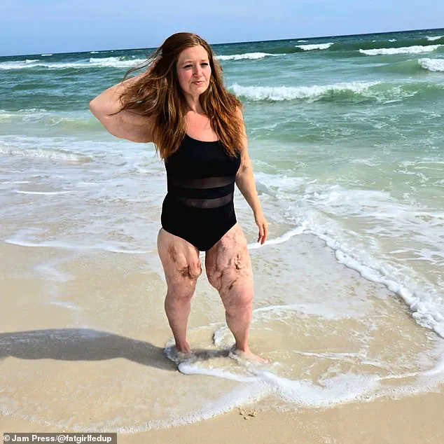 Weight-Loss Jabs Offer Rapid Weight Loss but Raise Concerns Over Loose Skin, Say Medical Professionals