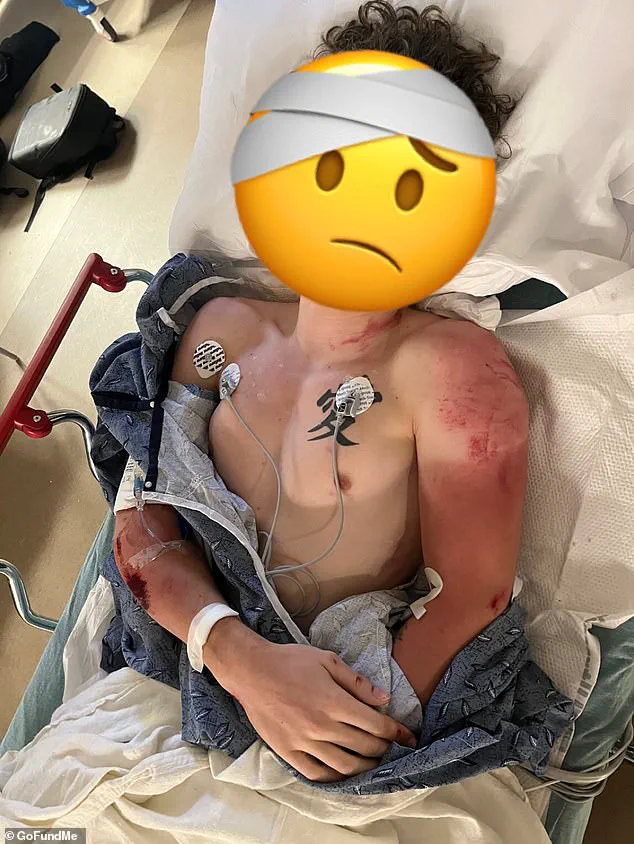 Critical Injuries After Police Car Runs Over Fleeing Motorcyclist in Georgia, Footage Goes Viral