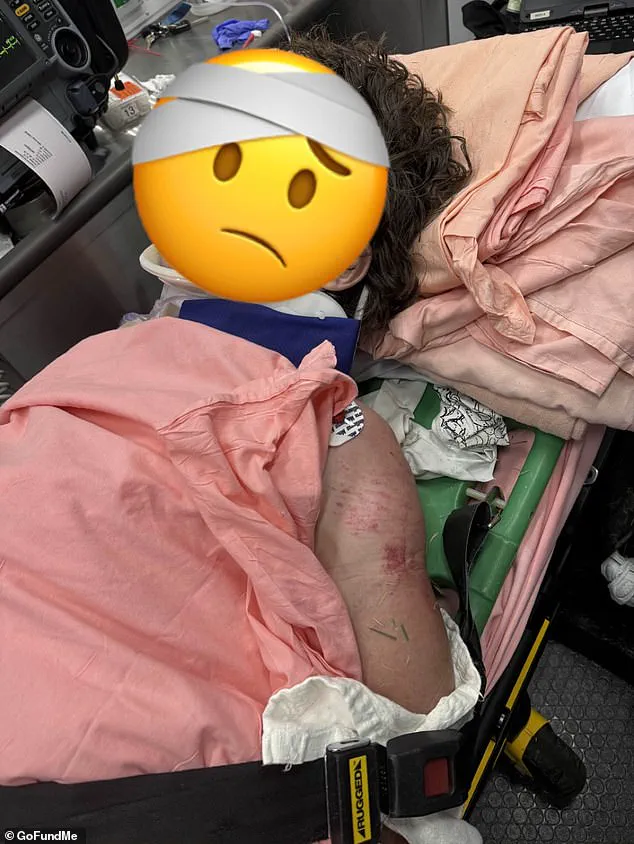 Critical Injuries After Police Car Runs Over Fleeing Motorcyclist in Georgia, Footage Goes Viral