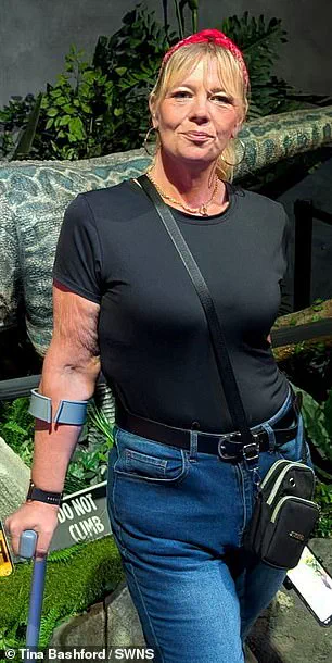 From 329lbs to Transformation: 'I Had Nothing to Lose' – Tina Bashford's Journey