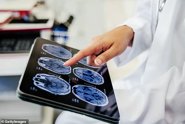 New Report Highlights 'Temporal Inequality' as Major Dementia Risk Factor, Comparable to Smoking and Pollution