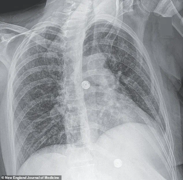 Intersection of Mental Health and Social Challenges: A Case Study on Systemic Support Needs