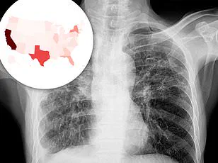 Intersection of Mental Health and Social Challenges: A Case Study on Systemic Support Needs