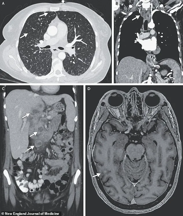 Intersection of Mental Health and Social Challenges: A Case Study on Systemic Support Needs