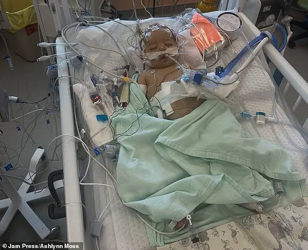 Newborn's Jaundice Sparks Concerns Over Early Detection and Parental Awareness