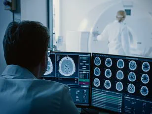 Urgent Alert: Dementia Caregivers Must Watch for Overlooked 'Sundowning' Symptom—1 in 5 Affected, Experts Warn