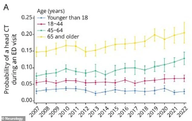 Surge in Head CT Scans Raises Questions About Overuse, According to Yale Study