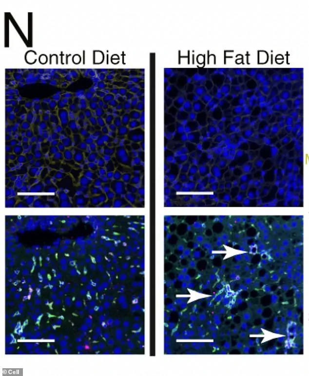 Urgent Alert: High-Fat Diet Triggers Immune Cell Rebellion in Liver, Fueling Cancer Risk