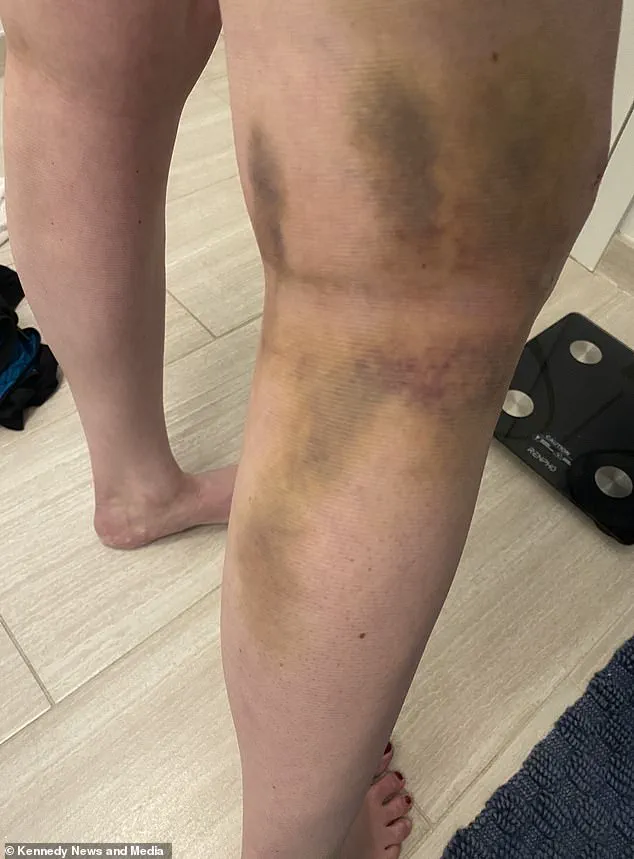 Long-Term Doctor-Patient Relationship Helps Woman Recover from Knee Injury