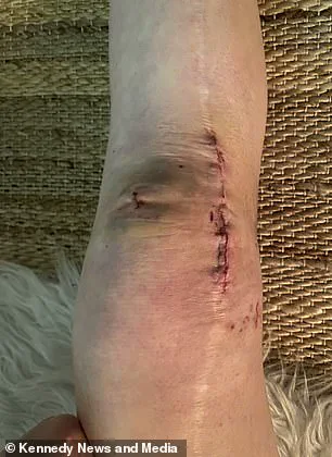 Long-Term Doctor-Patient Relationship Helps Woman Recover from Knee Injury