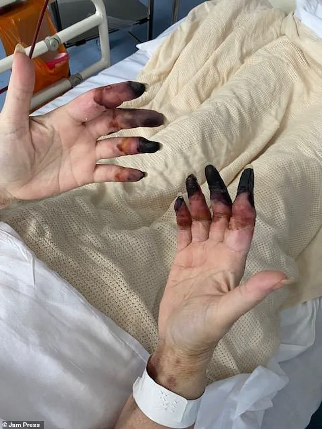 Urgent Medical Alert: Woman's Kidney Stone Misdiagnosis Highlights Critical Delays