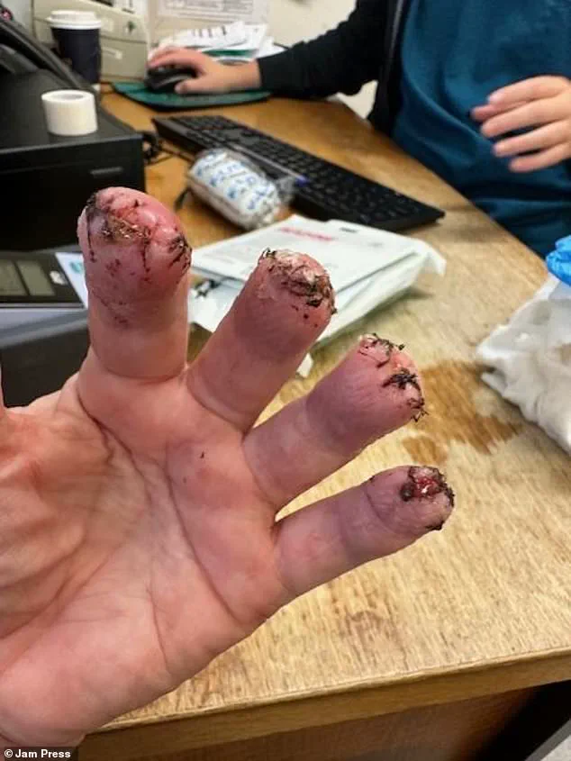 Urgent Medical Alert: Woman's Kidney Stone Misdiagnosis Highlights Critical Delays