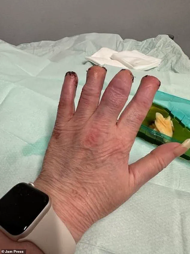 Urgent Medical Alert: Woman's Kidney Stone Misdiagnosis Highlights Critical Delays