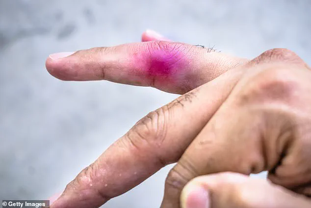 Nine-Year-Old Files Civil Lawsuit Against 11-Year-Old Peer Over Toy Dinosaur Incident at Alberta Daycare