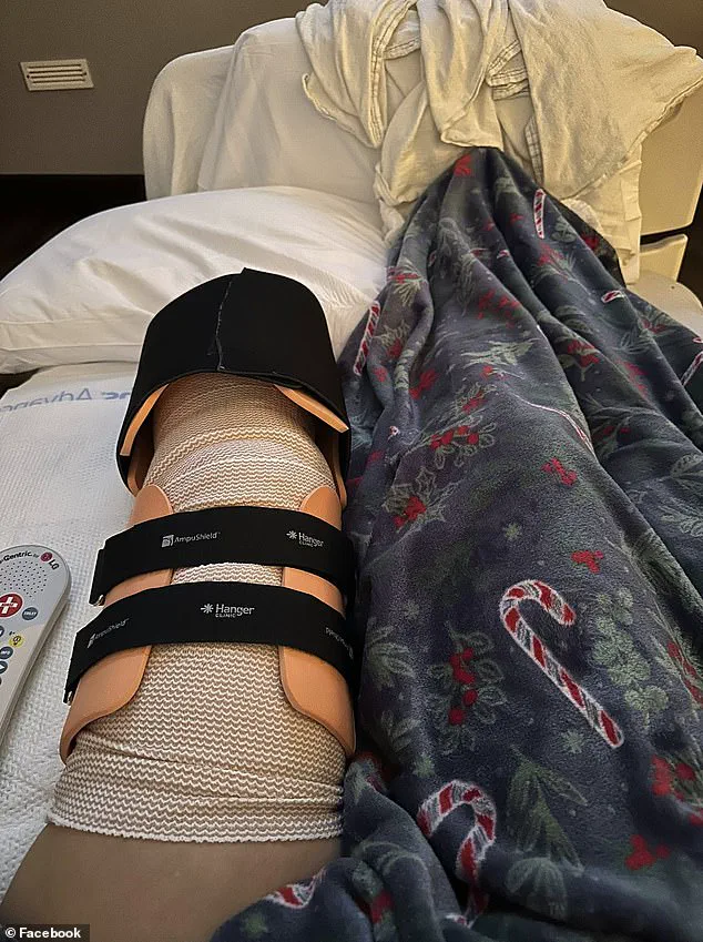 Tragic Dog Attack on Healthcare Worker Sparks Debate Over Pit Bull Ownership and Public Safety