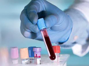 Breakthrough Discovery: Biological Differences Explain Male Disparity in Multiple Myeloma, Urging Immediate Research Shifts