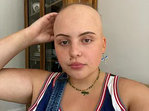 Impact of NHS Prescription Regulations on Asthma Patients' Access to Medication