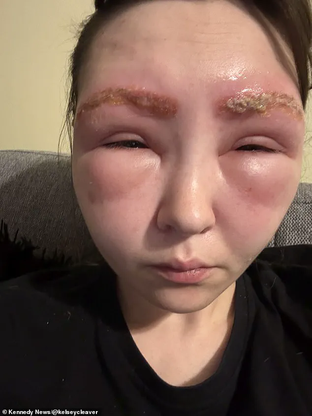 Alarming Aftermath of Eyebrow Tinting at Local Vancouver Salon