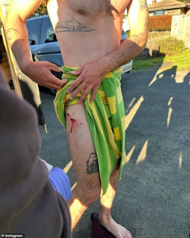 Exclusive: Surfer's Near-Death Encounter with 6ft Shark in Gualala, California