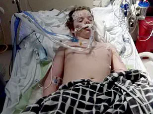 Doctors Urge Emergency Removal of Benadryl as Risks Outweigh Benefits, Say Medical Experts