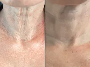 Surge in Female Hair Loss Sparks Calls for Public Awareness and Medical Action in the UK