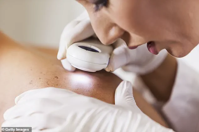 The Hidden Danger of Melanoma: How the Eyes Reveal an Overlooked Frontier