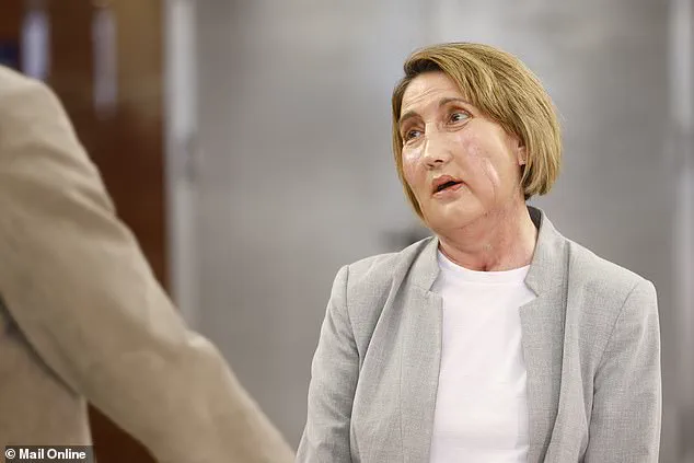 World's First Facial Transplant from Donor Who Chose Assisted Dying