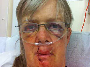 Dog Walker Rescued After Hour-Long Tree Climb as Aggressive Cow Sparks Dramatic Firefighter Intervention