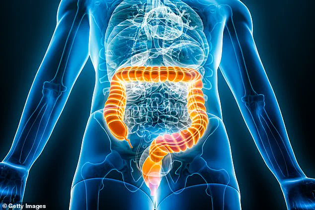 Bowel Cancer Surge Among Young Brits: Why the UK Differs from Europe in This Alarming Trend