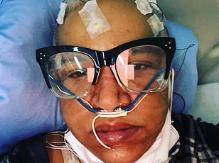 Study Links Long Covid to Increased Dementia Risk, Brain Changes Detected