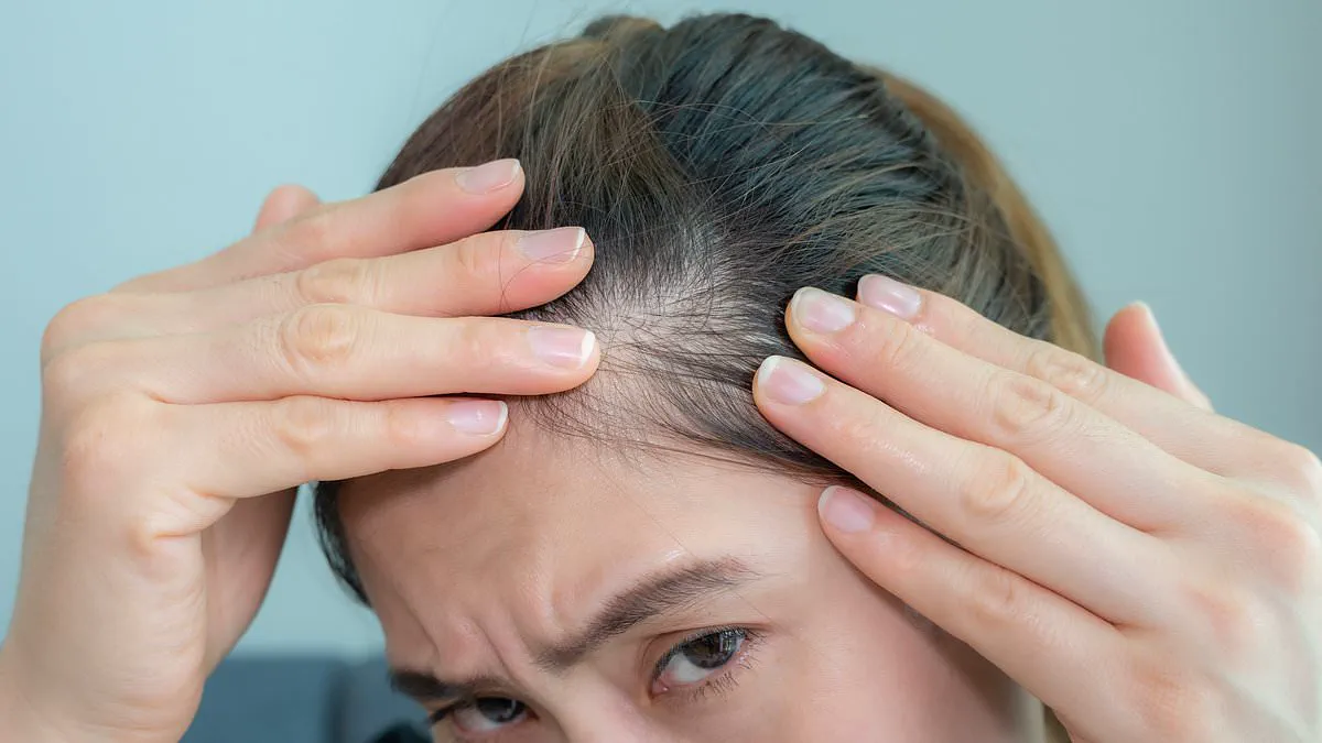 Menopause's Hidden Impact: Hair Loss Affects More Than Half of Women, Study Finds