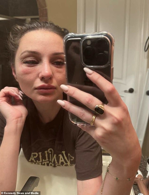 From Hair Loss to Health Crisis: The Mysterious Illness of a 28-Year-Old Student