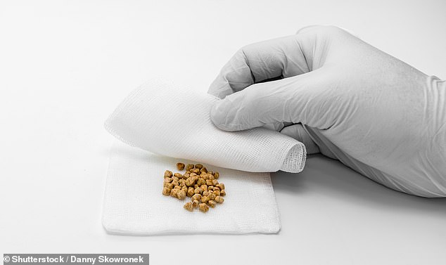 Study Finds Daily Cheese Consumption Linked to 26% Lower Gallstone Risk