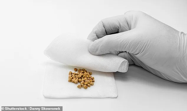 Study Finds Daily Cheese Consumption Linked to 26% Lower Gallstone Risk