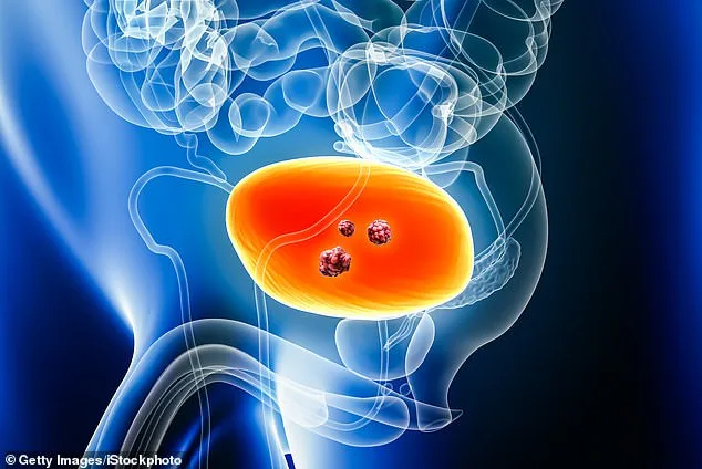 Breakthrough Treatment Approved on NHS Offers New Hope for Muscle-Invasive Bladder Cancer Patients