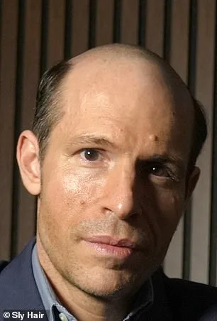 The Hidden Battle of Hair Loss: One Man's Struggle Against Baldness and Stigma