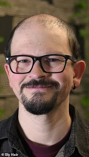 The Hidden Battle of Hair Loss: One Man's Struggle Against Baldness and Stigma