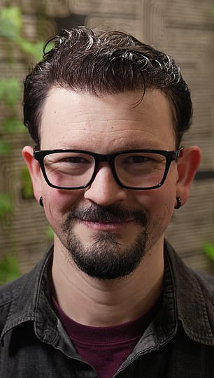 The Hidden Battle of Hair Loss: One Man's Struggle Against Baldness and Stigma