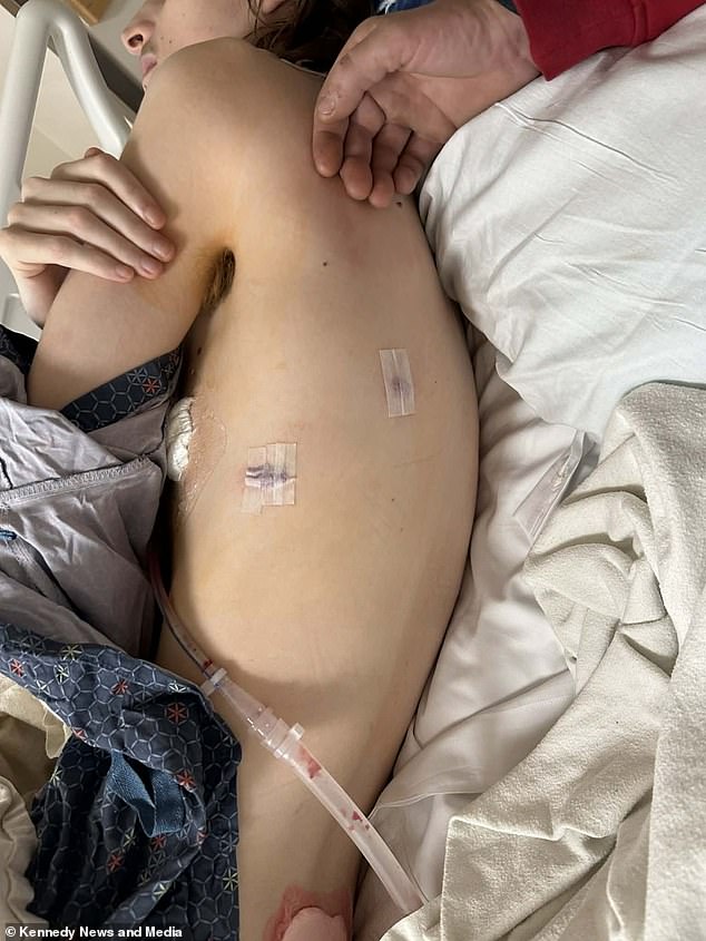 Kentucky Mother Pleads for Vaping Ban After Son's Life-Threatening Lung Collapse